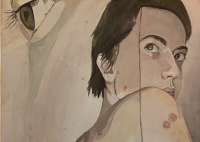 The Psoriasis Painting acrylic on canvas 48” x 24” 2024 $350